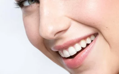 ¿Cuál es la duración de un blanqueamiento dental?
