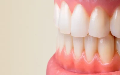 Curetaje dental