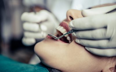 Revisión dental: qué es, cada cuánto hacerla y qué problemas puede detectar