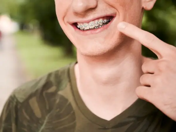 Persona sonriendo con brackets metálicos en los dientes